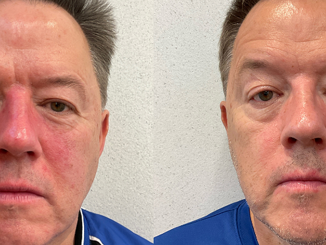 treatment before and after 2