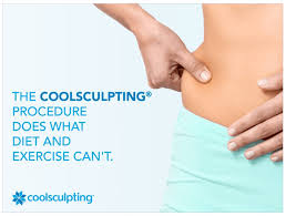 Coolsculpt your beach body NOW!
